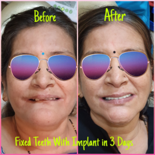 https://dentalimplantmumbai.in/wp-content/uploads/2021/10/COMPLETE-DENTAL-SOLUTIONS-2-320x320.png