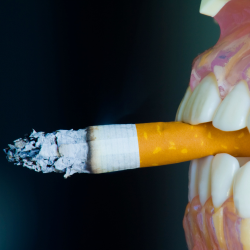 Reasons why smoking is bad for your teeth