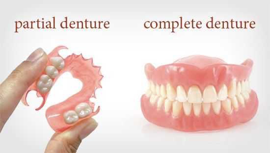 Dentures – What are the oral criteria to get them?