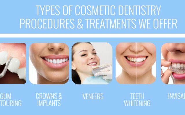 A brief on different types of Cosmetic Dental Procedure