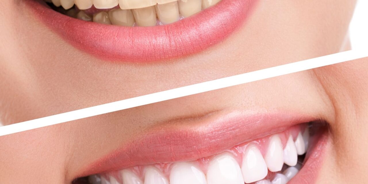 20 Things You Didn’t Know About your Teeth